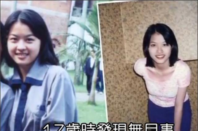 女明星生理缺陷_冯小刚白斑_明星病痛